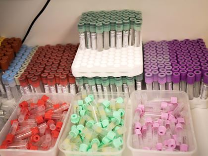 blood test tubes.JPG